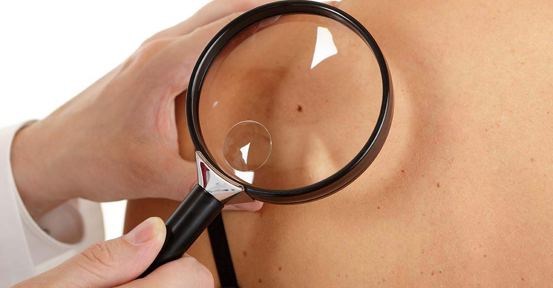Skin Check Hero